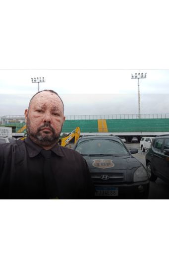 Vigilância em geral